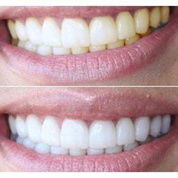 Карандаш для отбеливания зубов Luxury White Pro - фото 3 - id-p111415454