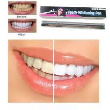 Отбеливание зубов гель-карандаш с кистью Teeth Whitening Pen - фото 1 - id-p111416473