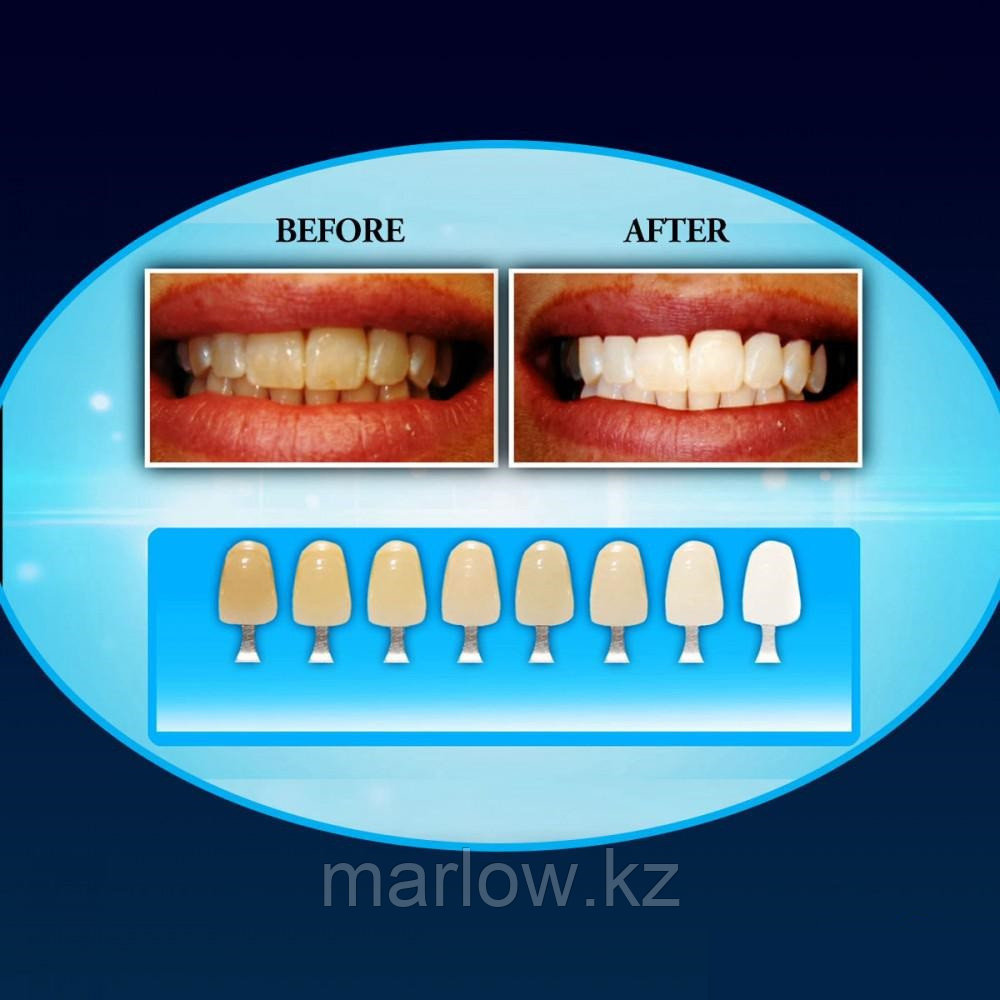 Система для отбеливания зубов 20 Minute Dental White - фото 4 - id-p111420130