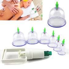 Вакумные банки, фото 1