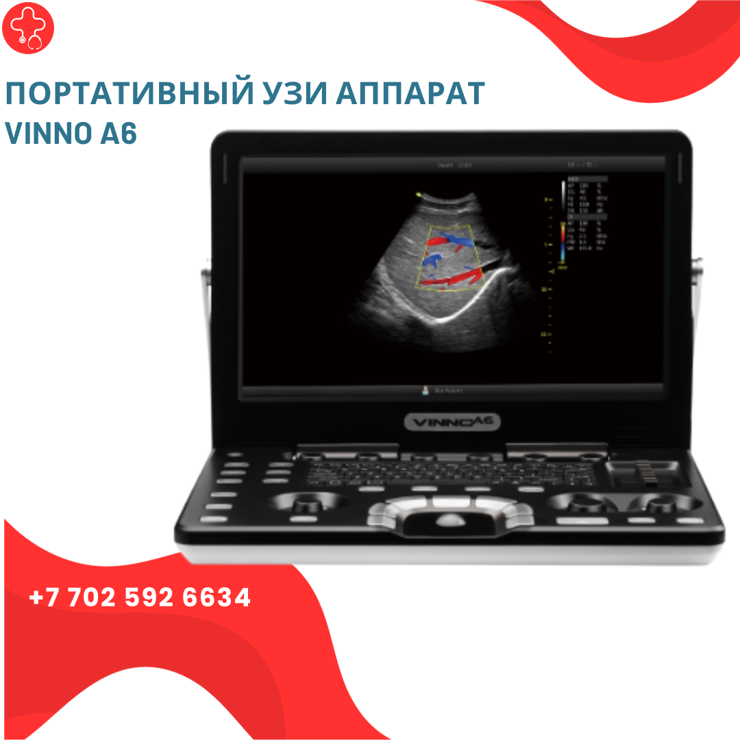 Портативный УЗИ аппарат Vinno A6 (портативный): продажа, цена в Алматы ...