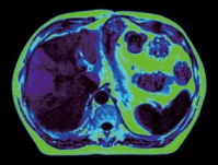 UMR 588 Магнитно-резонансный томограф UCS 1.5T МР - фото 6 - id-p111778321