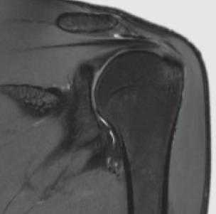 Магнитно-резонансный томограф uMROmega Ultra-Wide-Bore 3T - фото 8 - id-p111851308