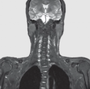 Магнитно-резонансный томограф Echelon Oval - фото 4 - id-p111851309