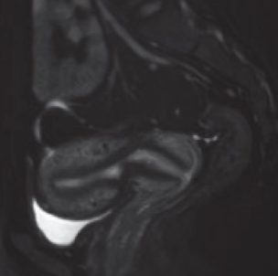 Магнитно-резонансный томограф Echelon Smart 1.5 - фото 4 - id-p111851500