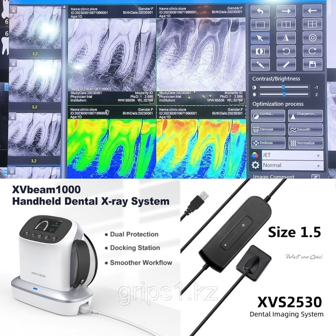 Рентген аппарат XpectVision XVbeam1000 + визиограф XVS2530 Большой размер + позиционер