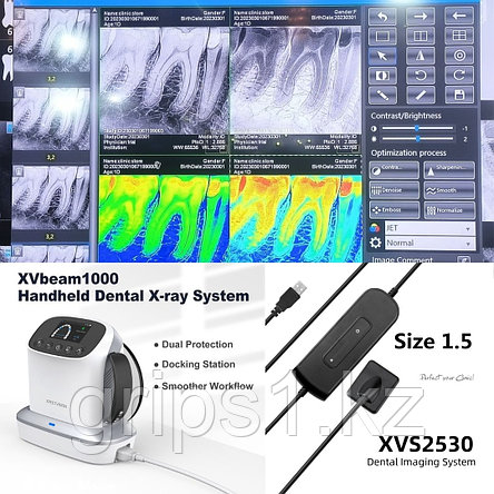 Рентген аппарат XpectVision XVbeam1000 + визиограф XVS2530 Большой размер + позиционер, фото 2