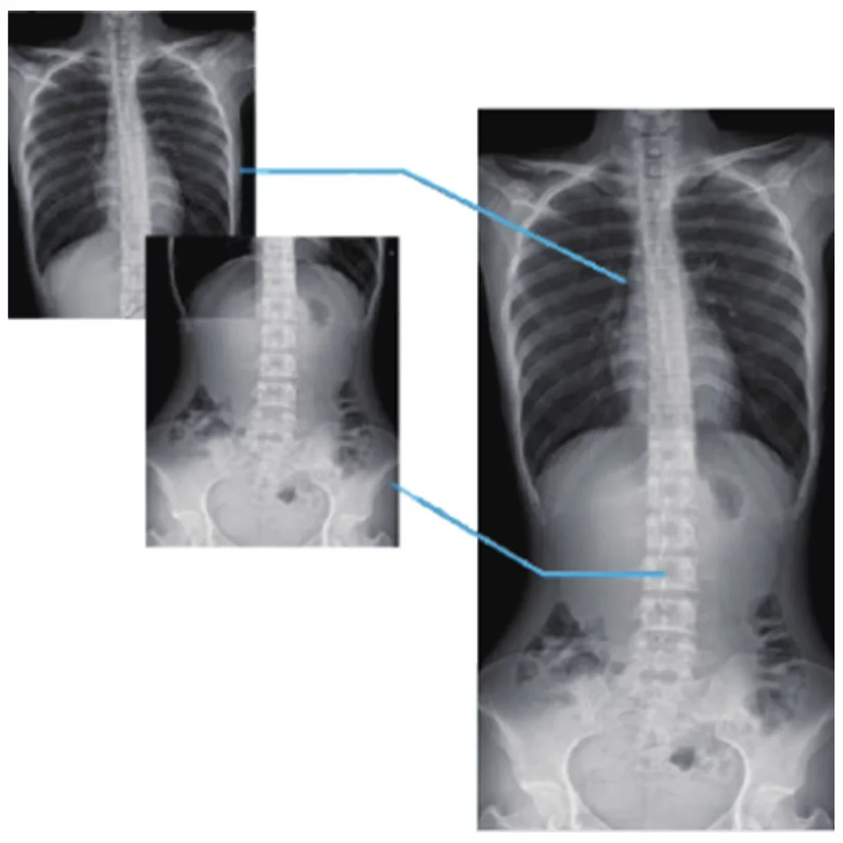 Система рентгеноскопии PLD9600A - фото 5 - id-p111990165