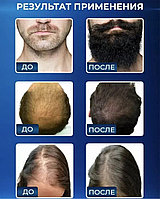 ТРИОКСИДИЛ Сыворотка для роста бороды и волос 15% ( производство Турция) 50мл.