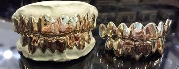 Грилзы, с открытыми зубами, бронза - фото 3 - id-p113463928