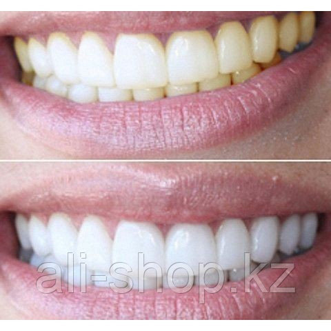 Отбеливающий карандаш для зубов Bright White - фото 2 - id-p113464083
