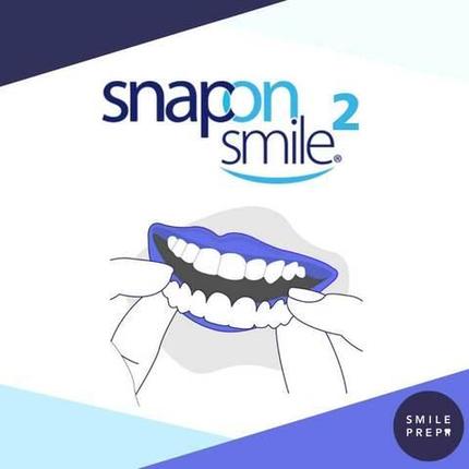 Виниры накладные на верхний и нижний ряд зубов Snap-on Smile X2, фото 1