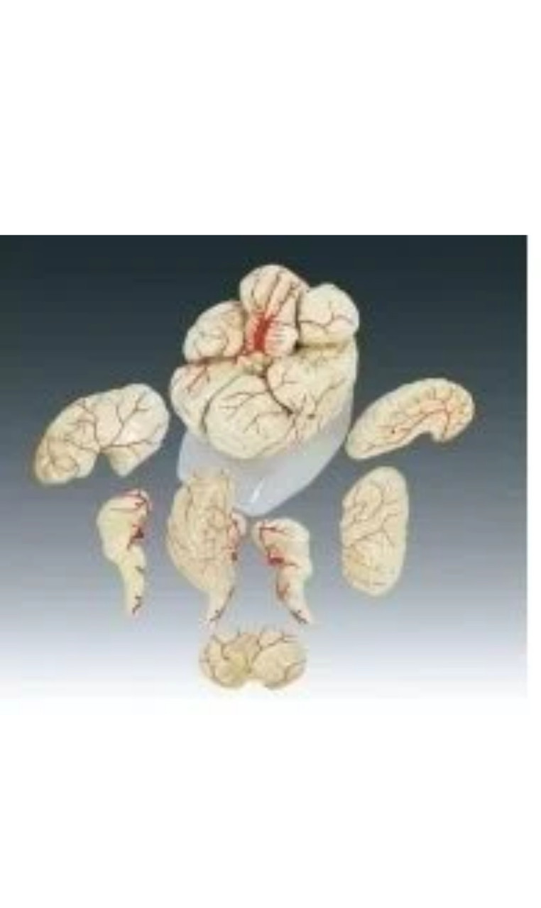 Модель «Мозг человека с артериями» - фото 1 - id-p113846747