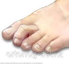 Жезөкшелердің кискасының шынайы фотолары