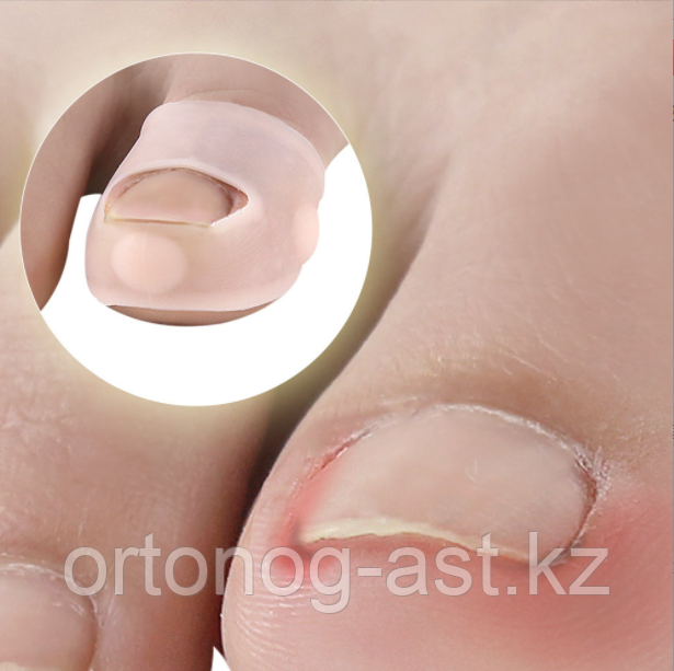Силиконовые корректирующие подушечки для лечения вросших ногтей. - фото 6 - id-p114092903