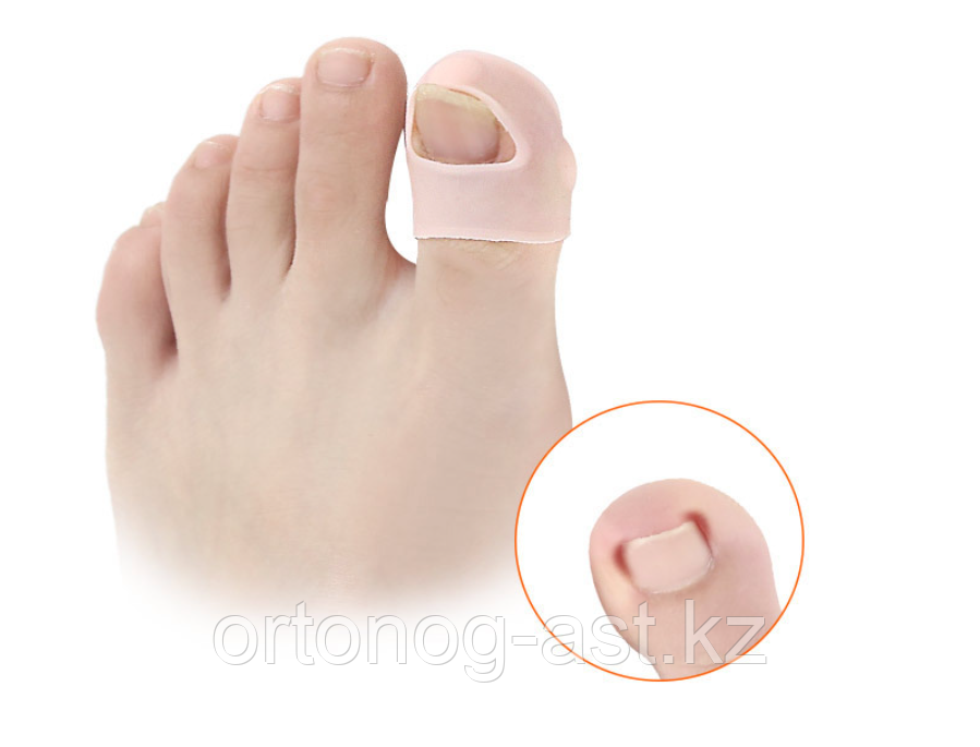 Силиконовые корректирующие подушечки для лечения вросших ногтей. - фото 7 - id-p114092903