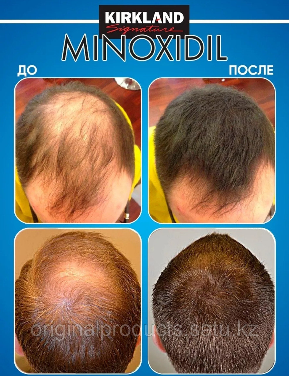 АКЦИЯ! 6шт Миноксидил 5% | Minoxidil 5% для роста бороды и от облысения. Каспи ред - фото 3 - id-p114667418