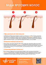 Постер№3 ВИДЫ ВРОСШИХ ВОЛОС