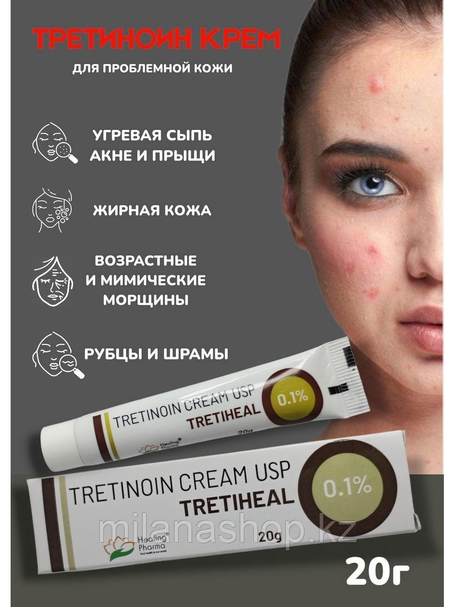 Третиноин 0,1% ( Tretinoin cream Healing Pharma ) крем для лечения прыщей и омоложения кожи 20 гр - фото 1 - id-p115271815