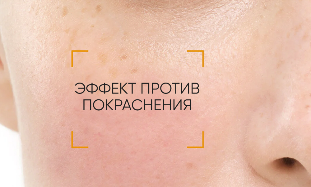 PHOTODERM AR SPF50+ 30ML Солнцезащитный крем с тон.эффектом для кожи с покраснениями - фото 3 - id-p115599955