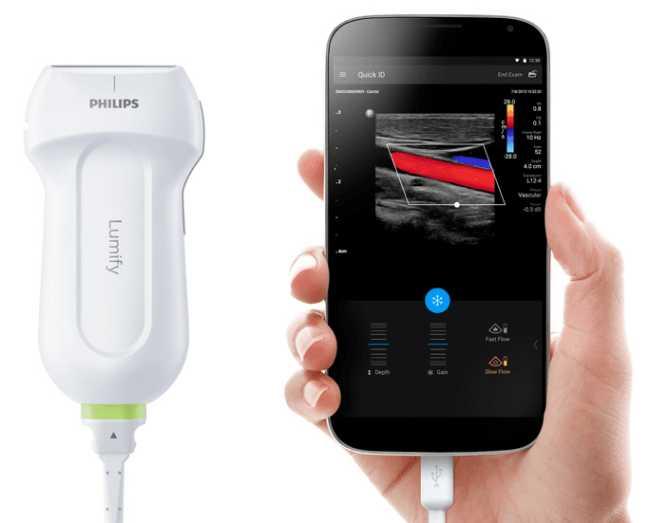 Мобильная ультразвуковая диагностическая система Philips Lumify - фото 2 - id-p115778217