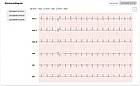 Многофункциональный интеллектуальный браслет. ECG Lite, фото 4