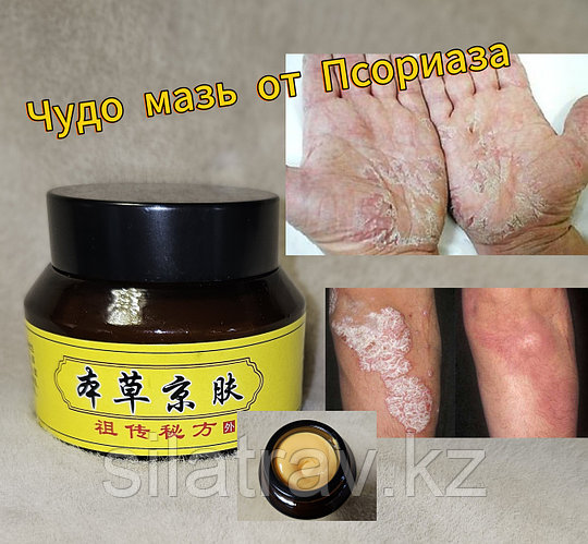 Талай балапандар төрт аяғын тік тұрғызып алады