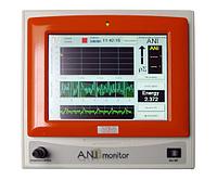 ANI Monitor - cистема непрерывного мониторинга обезболивания