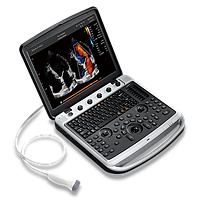 УЗИ аппарат SonoTouch 80 Expert (Sonobook 9)