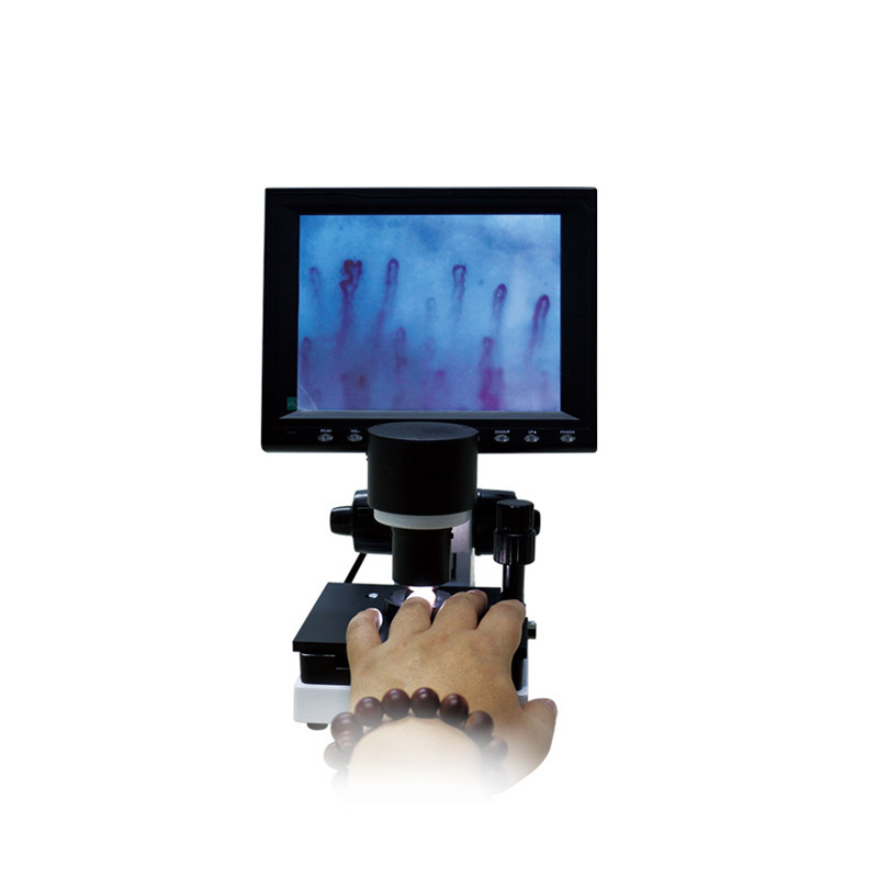 Микроциркуляционный микроскоп WXH-8 WXH-10 WXH-12, фото 1