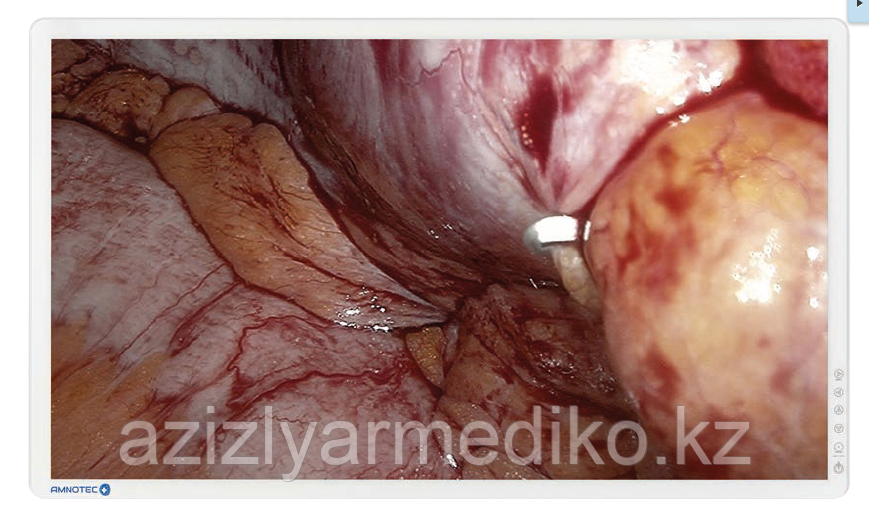 Медицинский монитор UHD диагональю 43