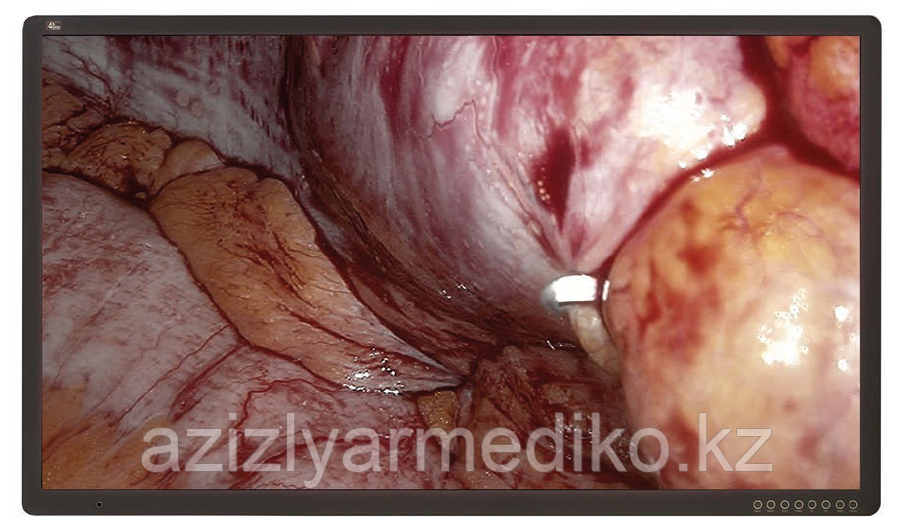 Медицинский монитор UHD диагональю 55