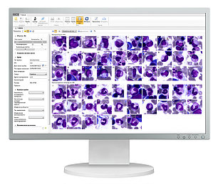 Гематология