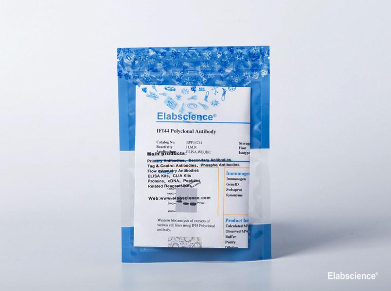 P70 S6 kinase alpha Моноклональное антитело