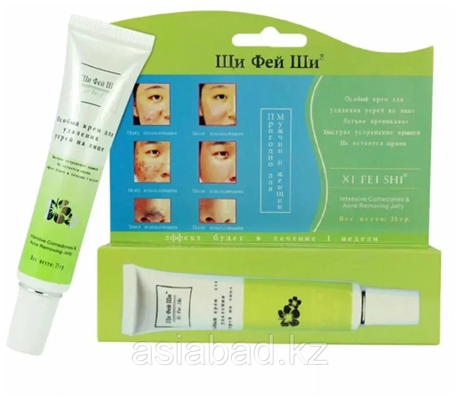 Щи Фей Ши - Особый крем для удаления угрей ( зеленый ), фото 1