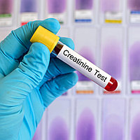 Бүйрек сынақтары: мочевина, креатинин