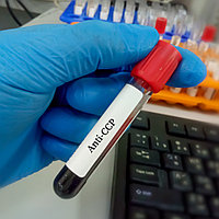 ЦЦПA (циклдік цитрулинделген пептидке антиденелер)