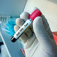 Тиропероксидазаға антиденелер (анти-ТПО) (қан сарысуында)