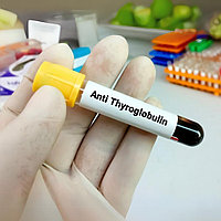 Тироглобулинге антиденелер (анти-ТГ)