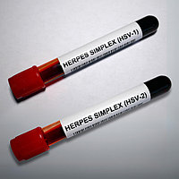 Қарапайым герпес вирусы (ҚГВ) 1,2 IgM + IgG (ИФТ)