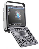 Портативный ультразвуковой сканер SonoScape, S8Exp