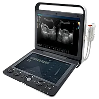 Портативный ультразвуковой сканер SonoScape, S9