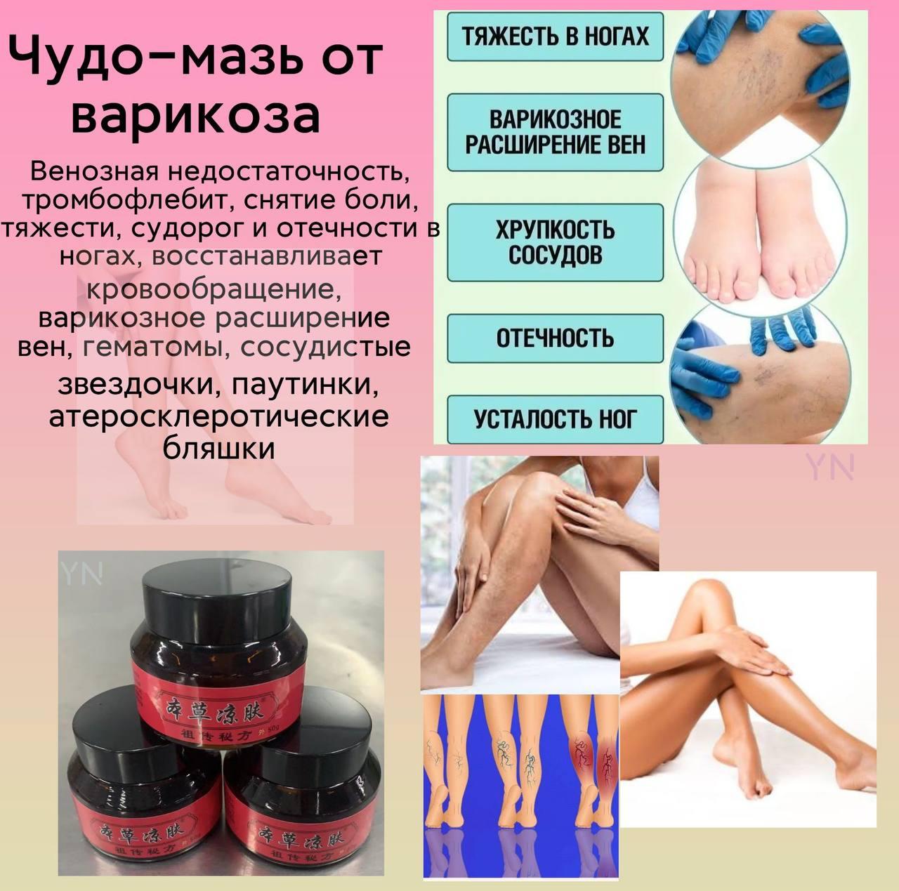 Чудо-мазь от варикоза