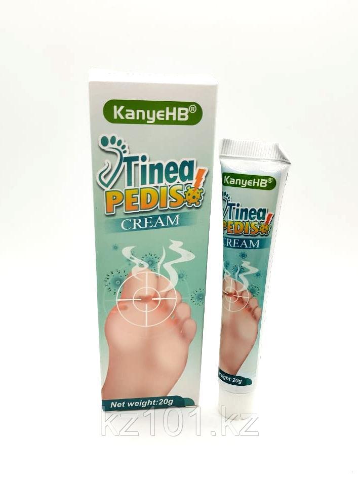 Крем для лечения грибка стопы Tinea Pediso, фото 1