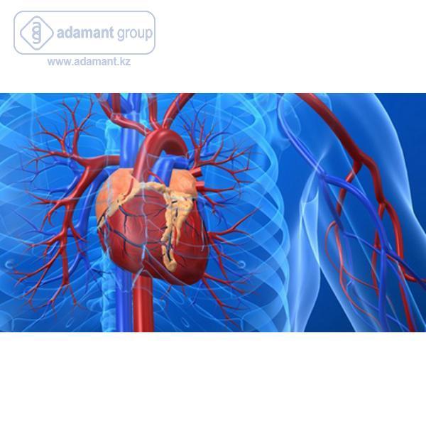 Сосудистая хирургия, ESDP