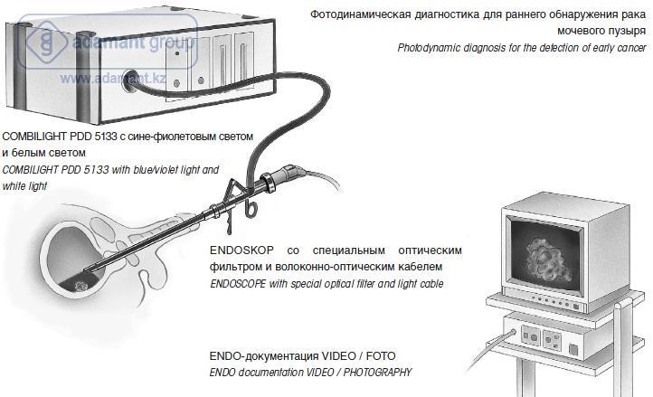Фотодинамическая диагностика PDD