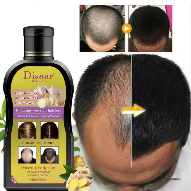 Disaar Anti- hair loss & Hair Growth + GINGER Шампунь Против выпадения волос ИМБИРЬ 200 мл, фото 1