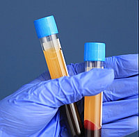 Пробирка вакуумная с синей крышкой с цитратом натрия 3,2% 8.1мл