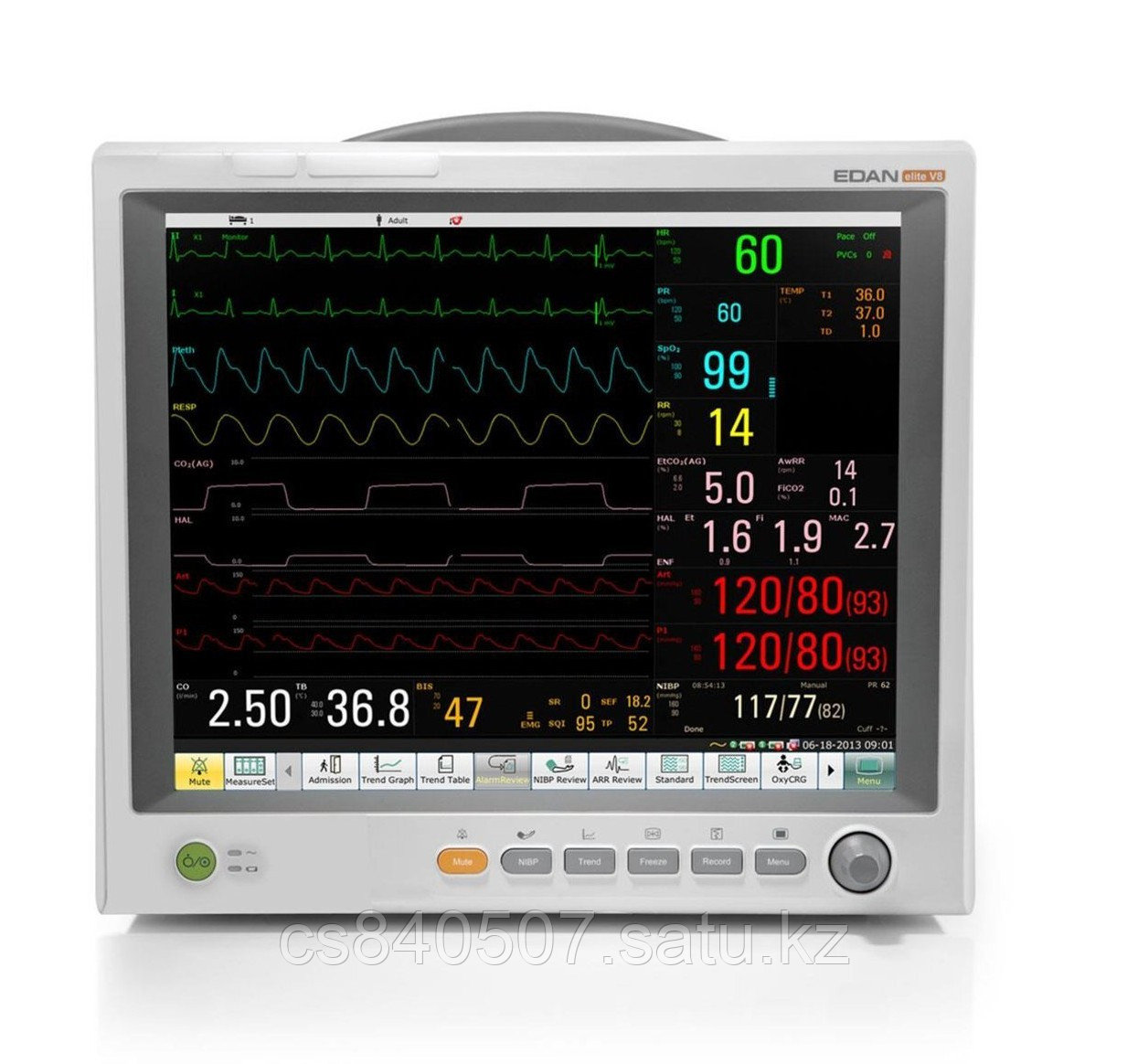 Модульный монитор пациента Elite V8 EDAN - фото 1 - id-p123378617