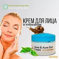 Крем для лица Lady Diana от угрей и шрамов, 80г